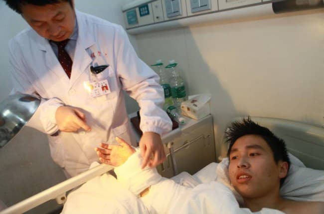 Severed Hand Attached to a Man’s Ankle