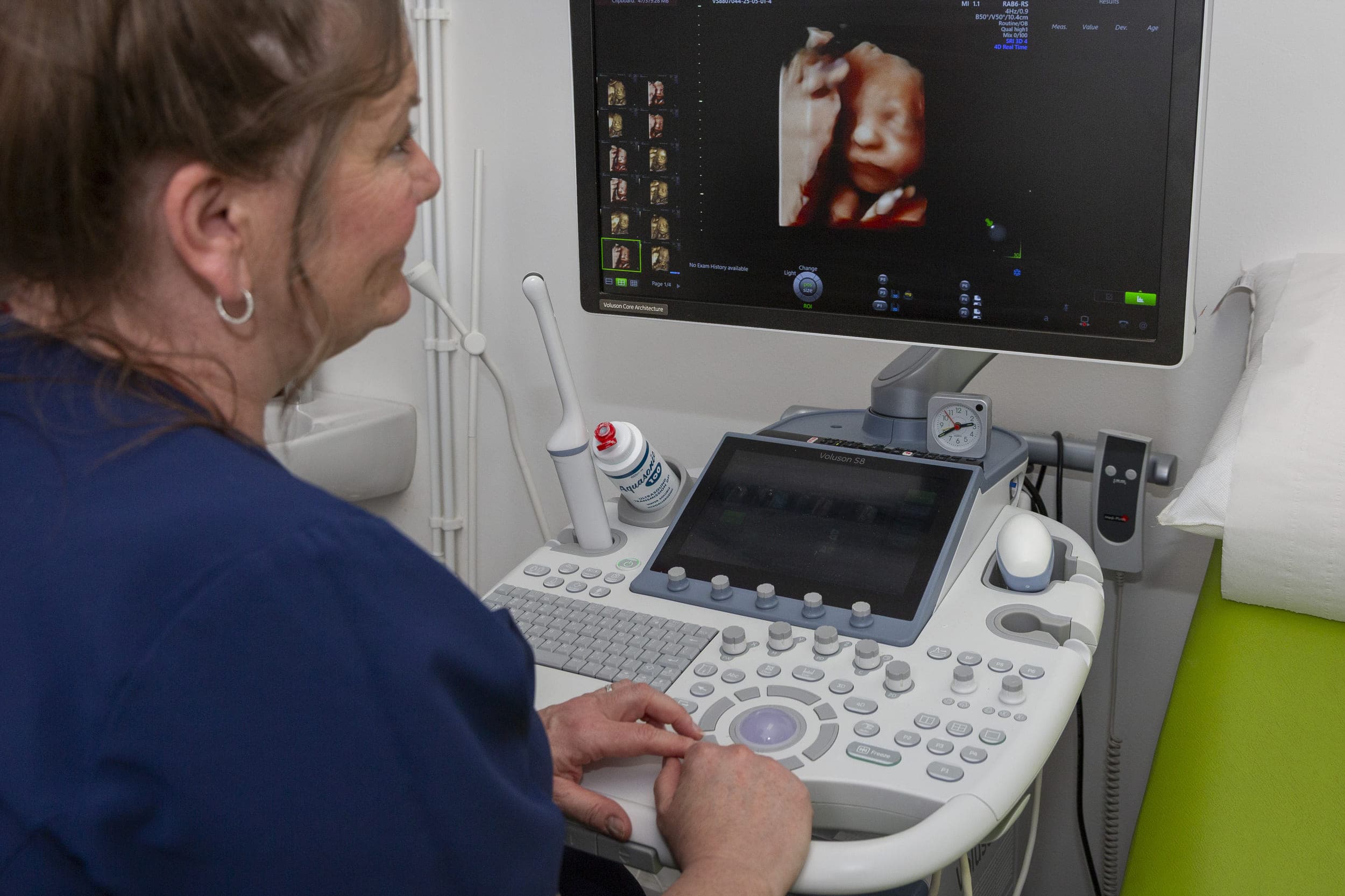 Melanie’s Mission: Personalised Pregnancy Scans in Consett