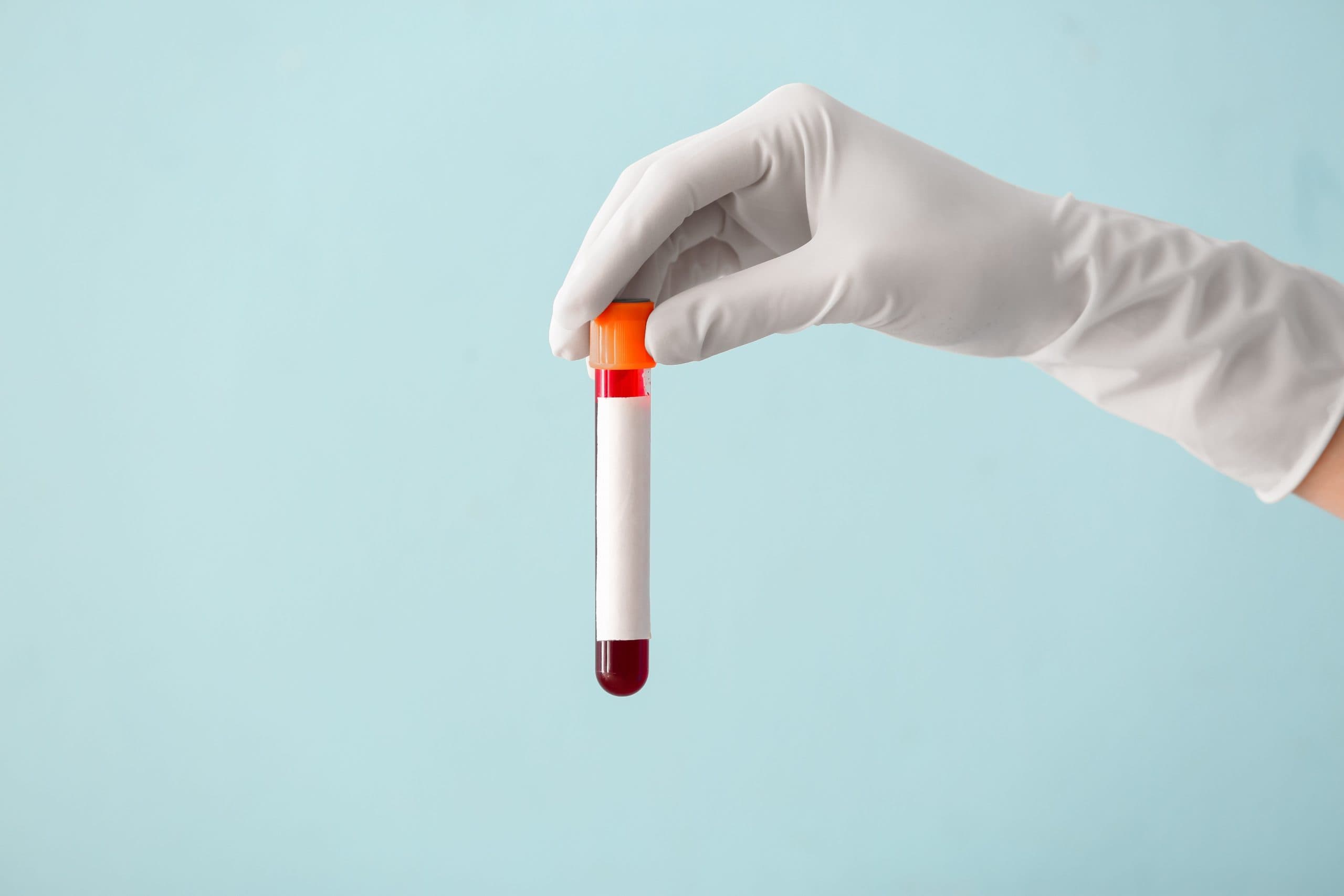 Achieve a Healthier You This October with ELYFIT: Private Blood Tests